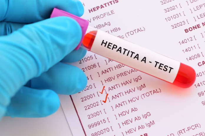 HEPATITA A - Test