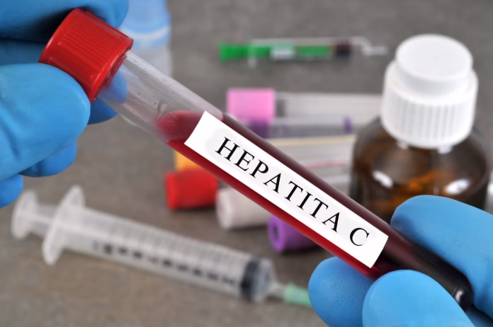 HEPATITA C