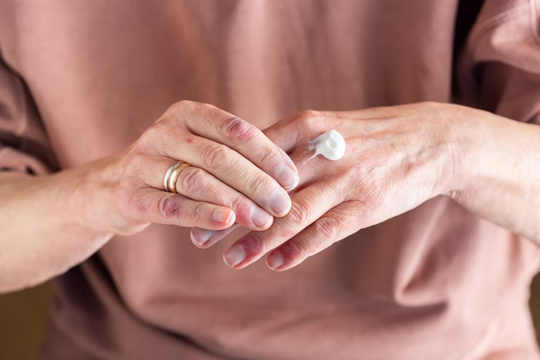 Dermatita atopică: ce este, de ce apare și cum o putem controla
