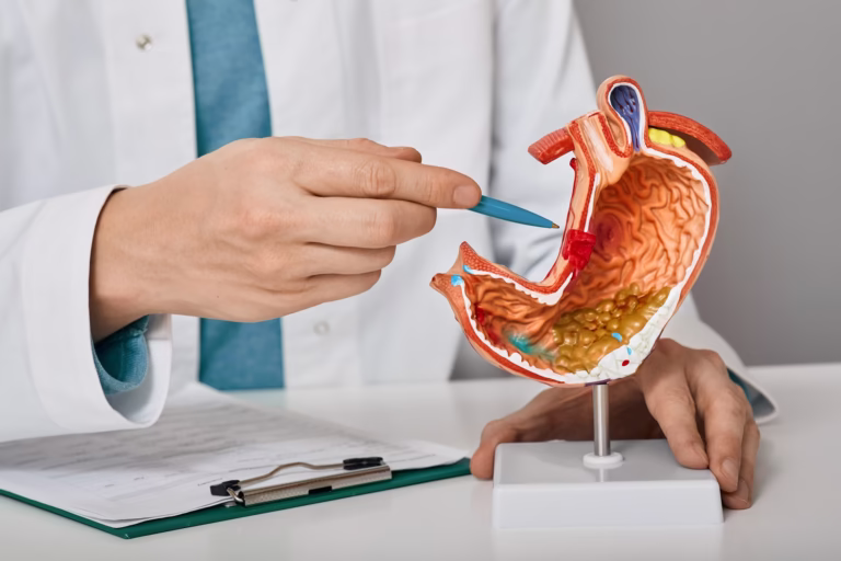 Ce este ulcerul gastric și duodenal?